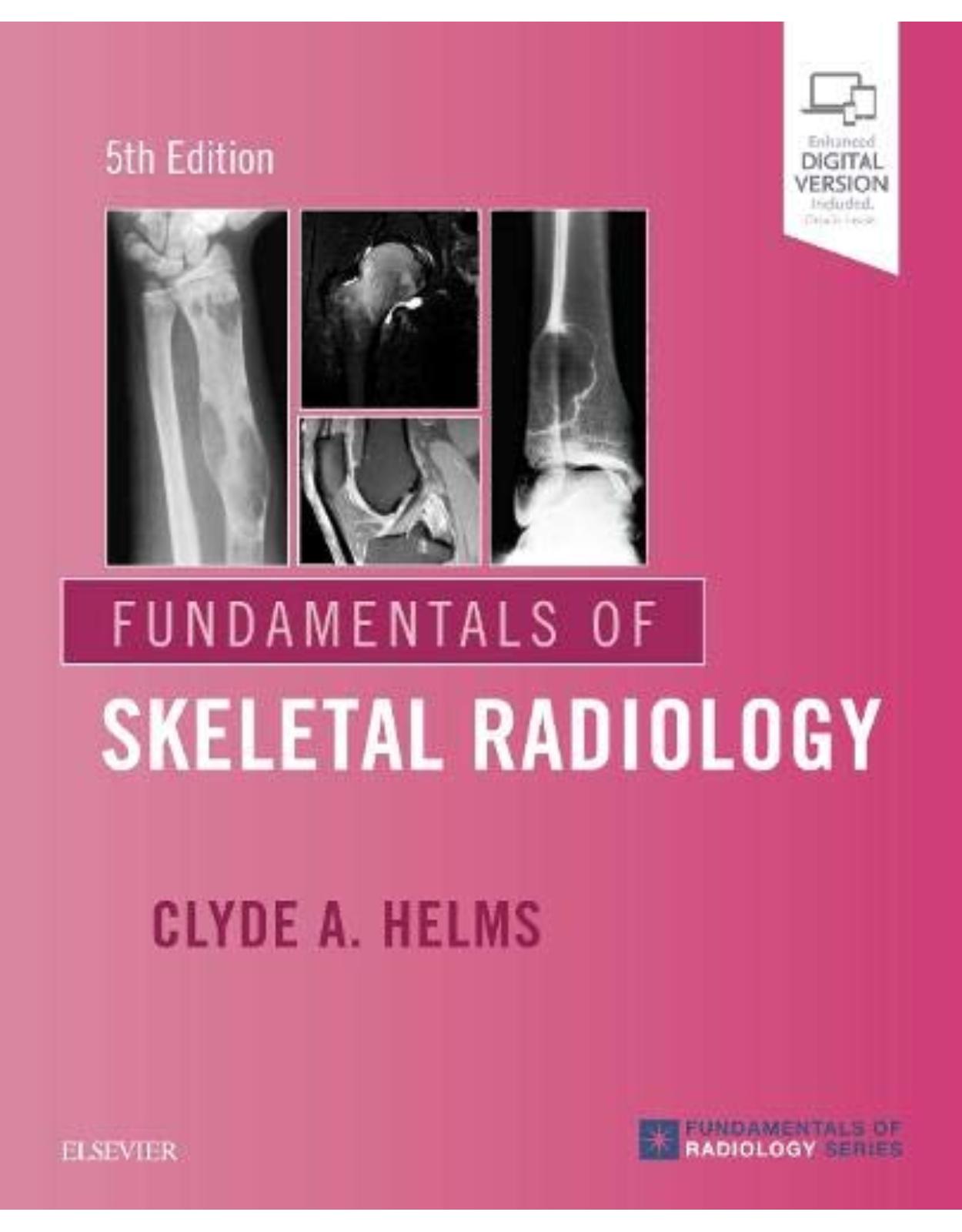 Fundamentals of Skeletal Radiology 