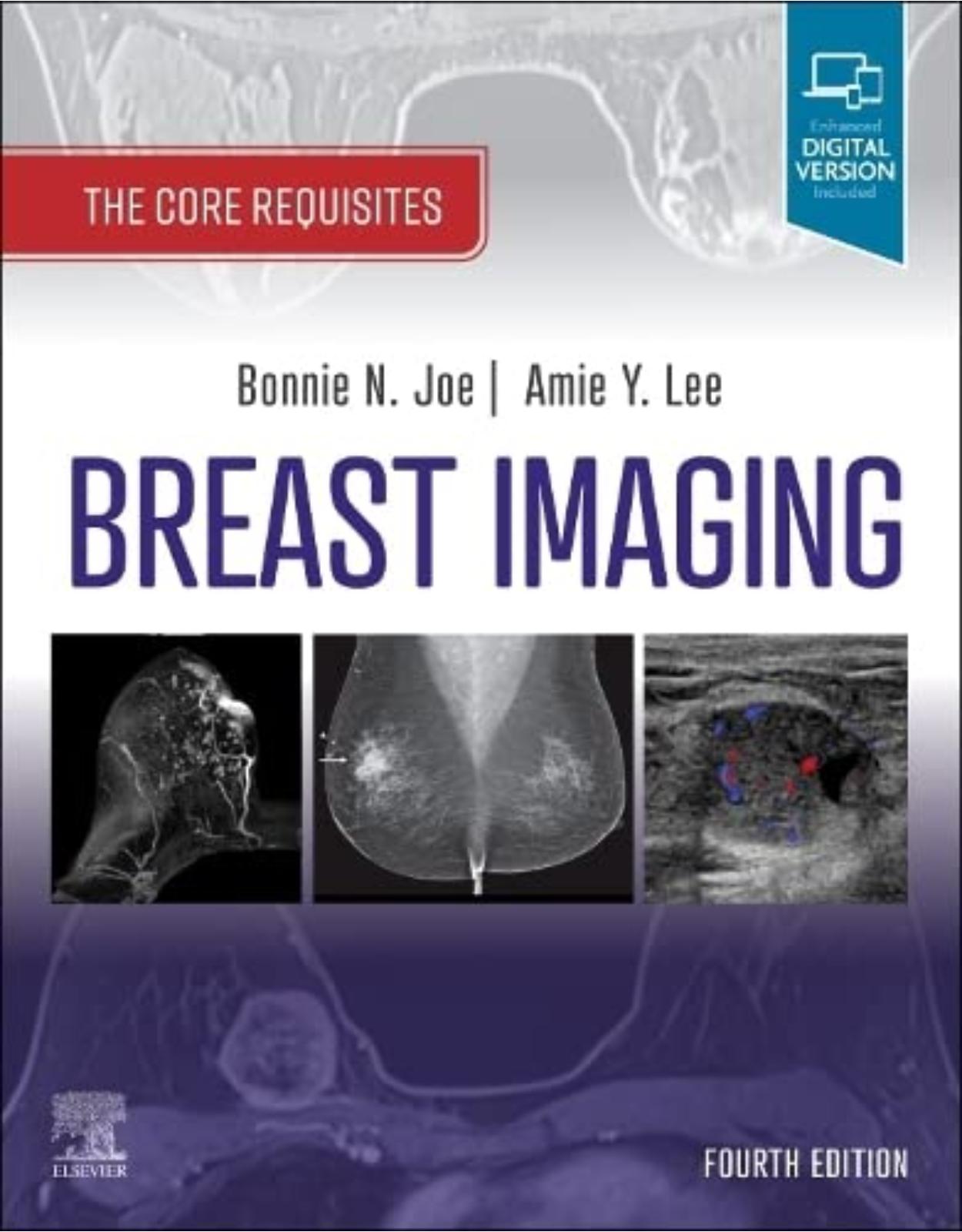 Breast Imaging: The Core Requisites 