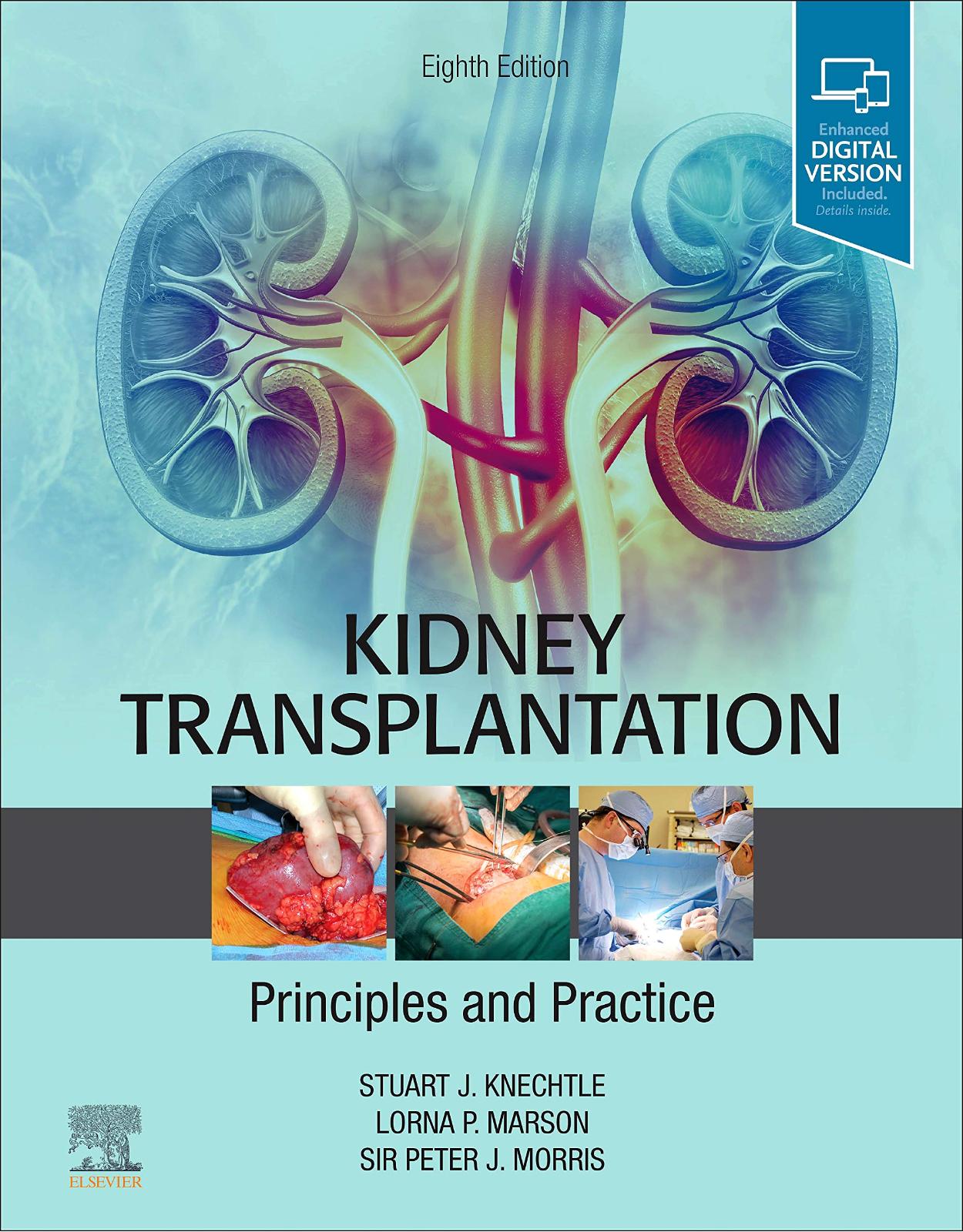 Kidney Transplantation - Principles and Practice: Expert Consult - Online and Print