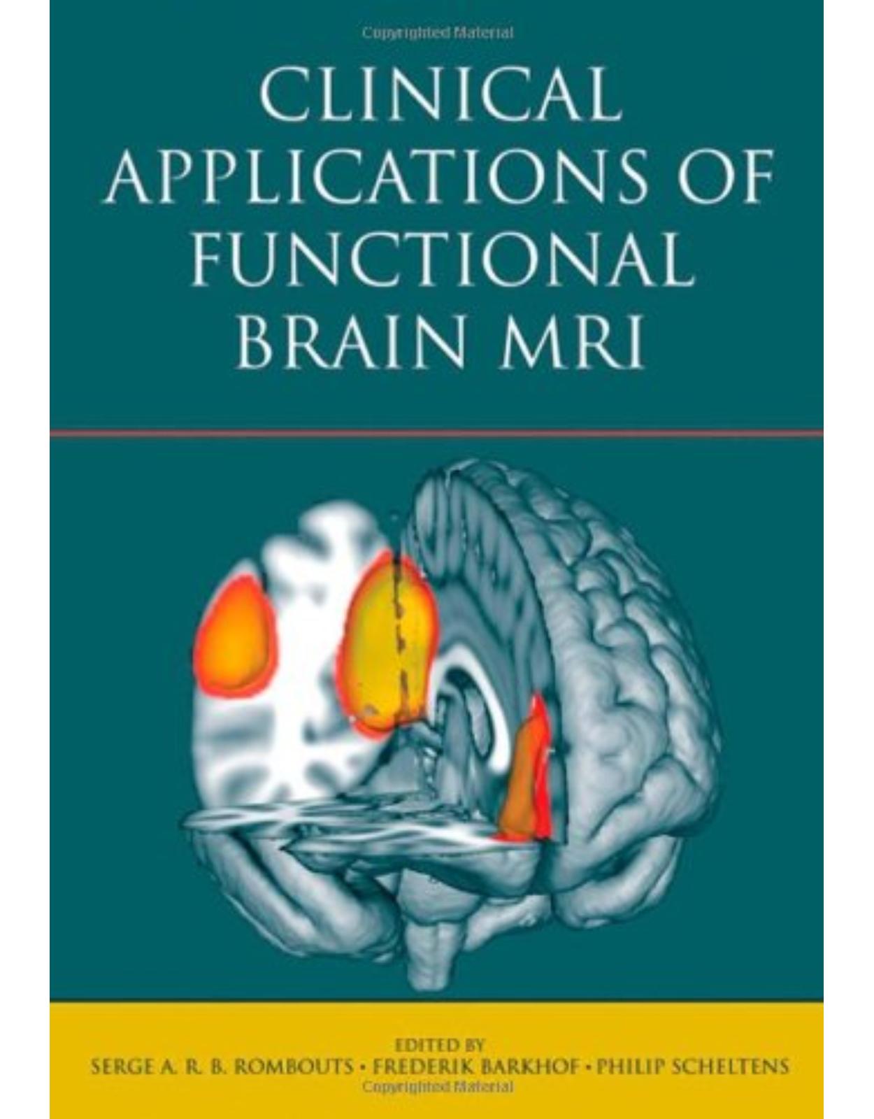 Clinical Applications of Functional Brain MRI