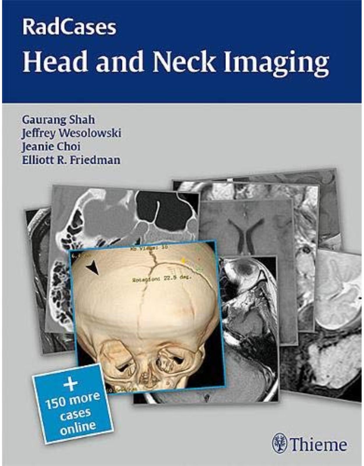 Head and Neck Imaging (Radcases Plus Q&A)