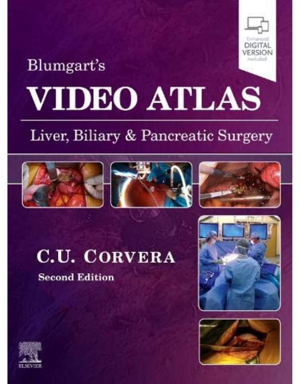 Video Atlas: Liver, Biliary & Pancreatic Surgery