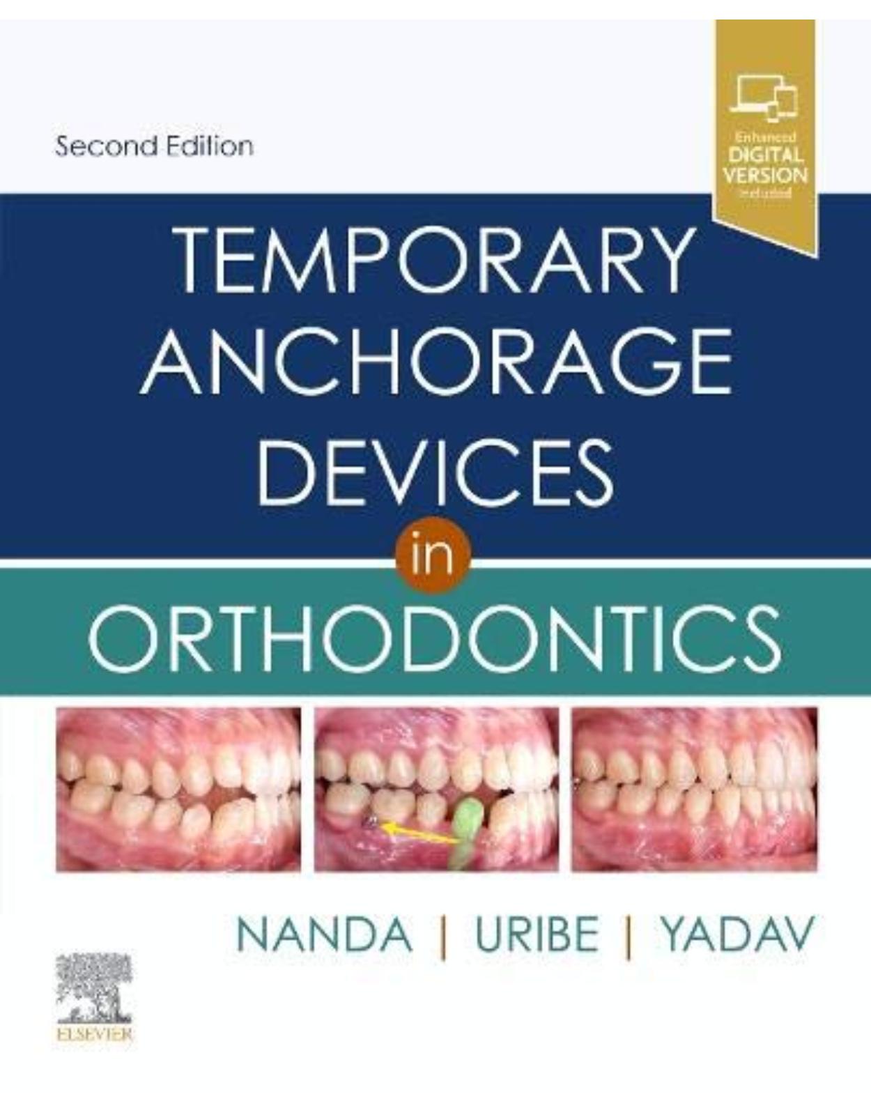 Temporary Anchorage Devices in Orthodontics