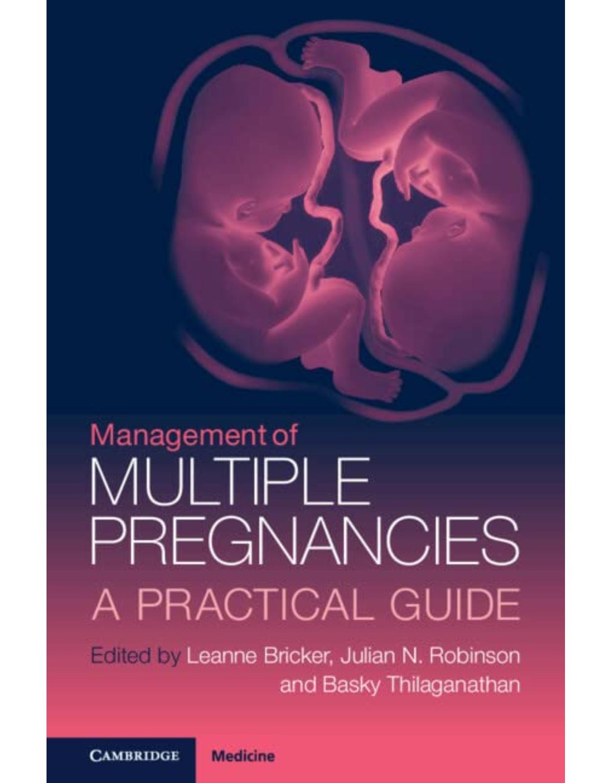 Management of Multiple Pregnancies: A Practical Guide