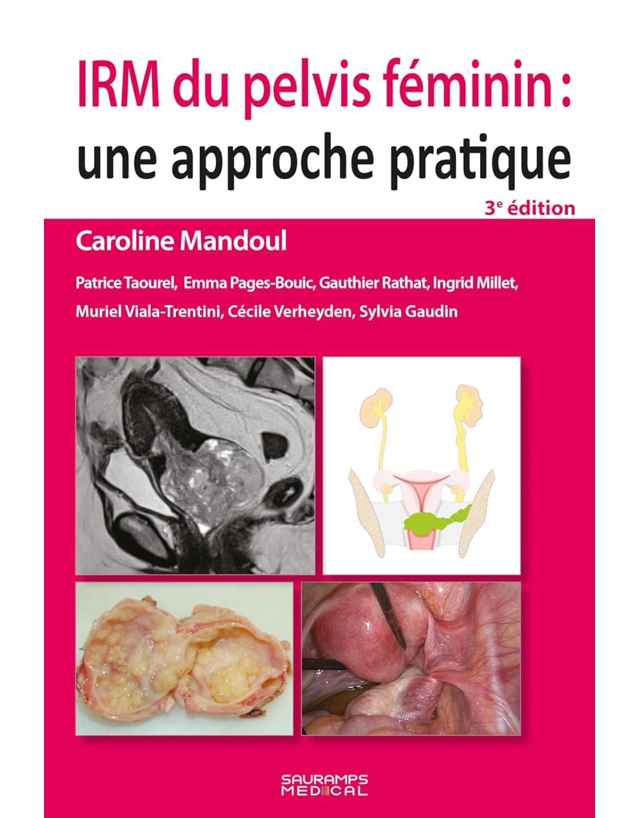IRM du pelvis f�minin: une approche pratique 3e ed