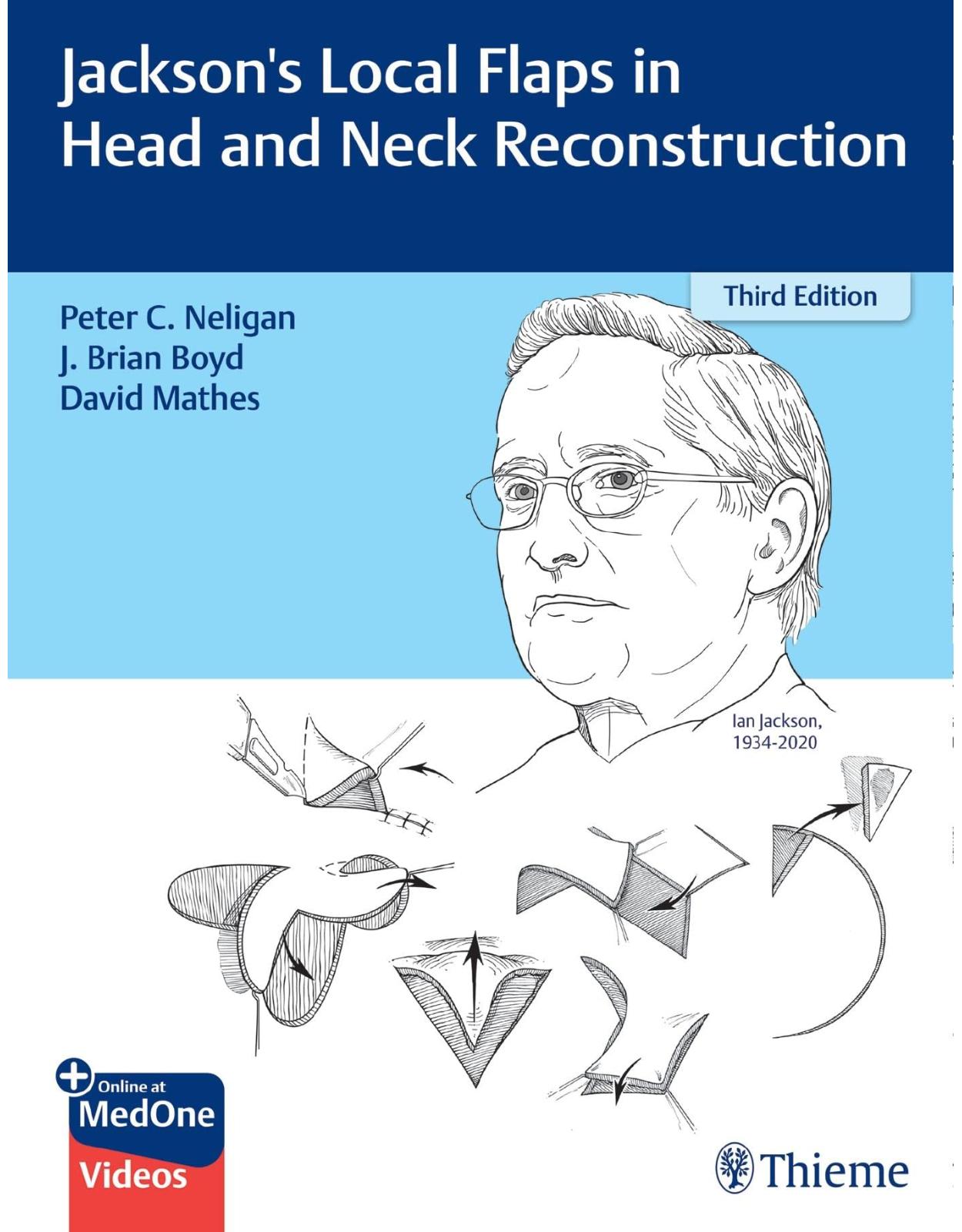 Jackson's Local Flaps in Head and Neck Reconstruction