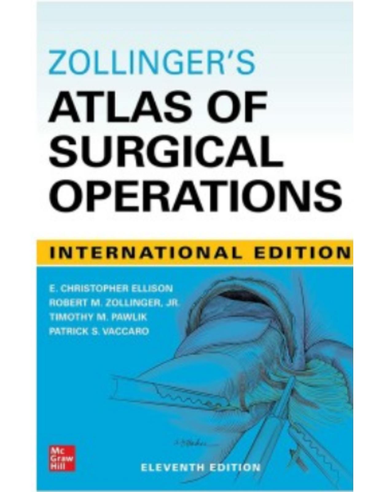 Zollinger’s Atlas Of Surgical Operations, Eleventh Edition