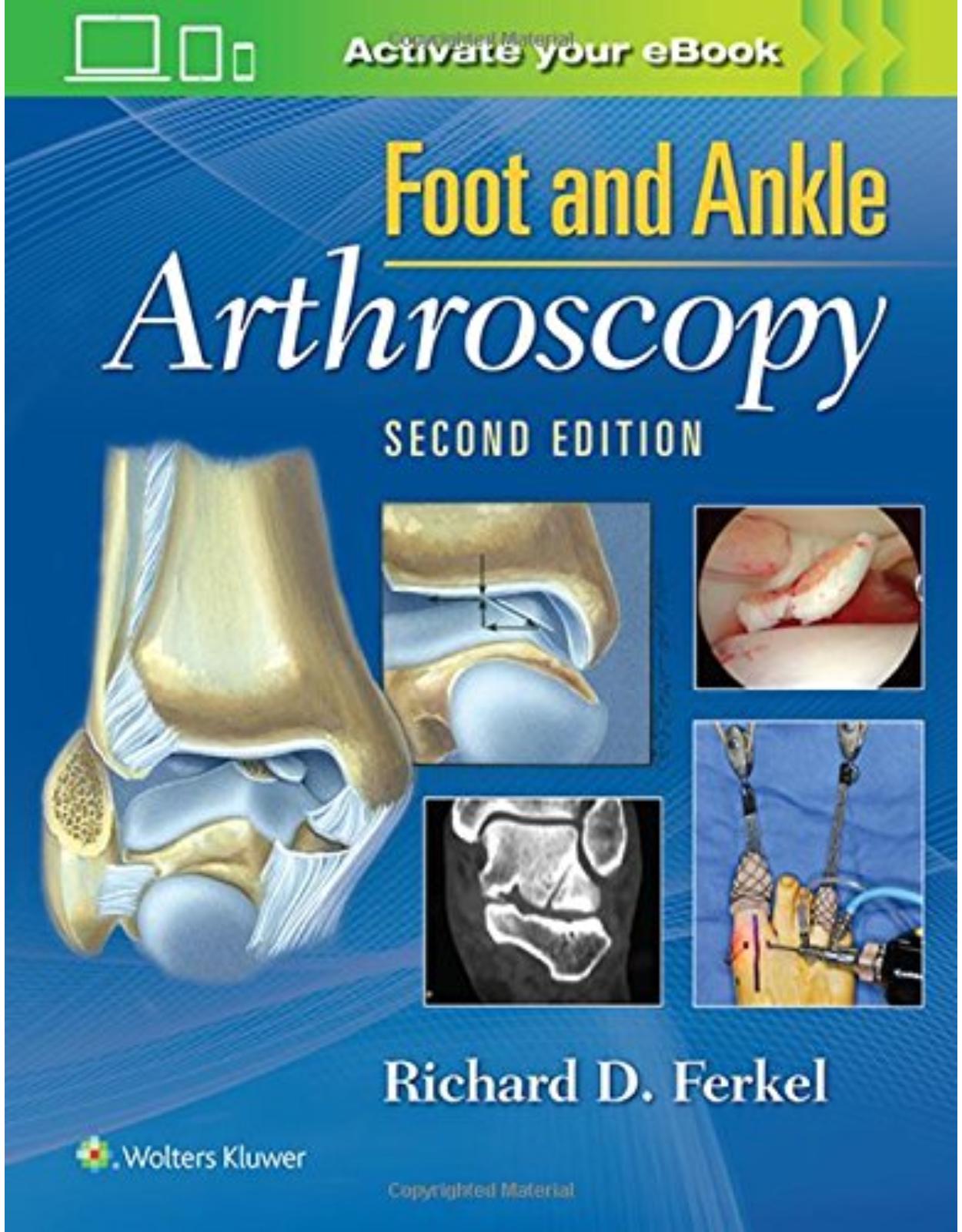 Foot & Ankle Arthroscopy, 2e 