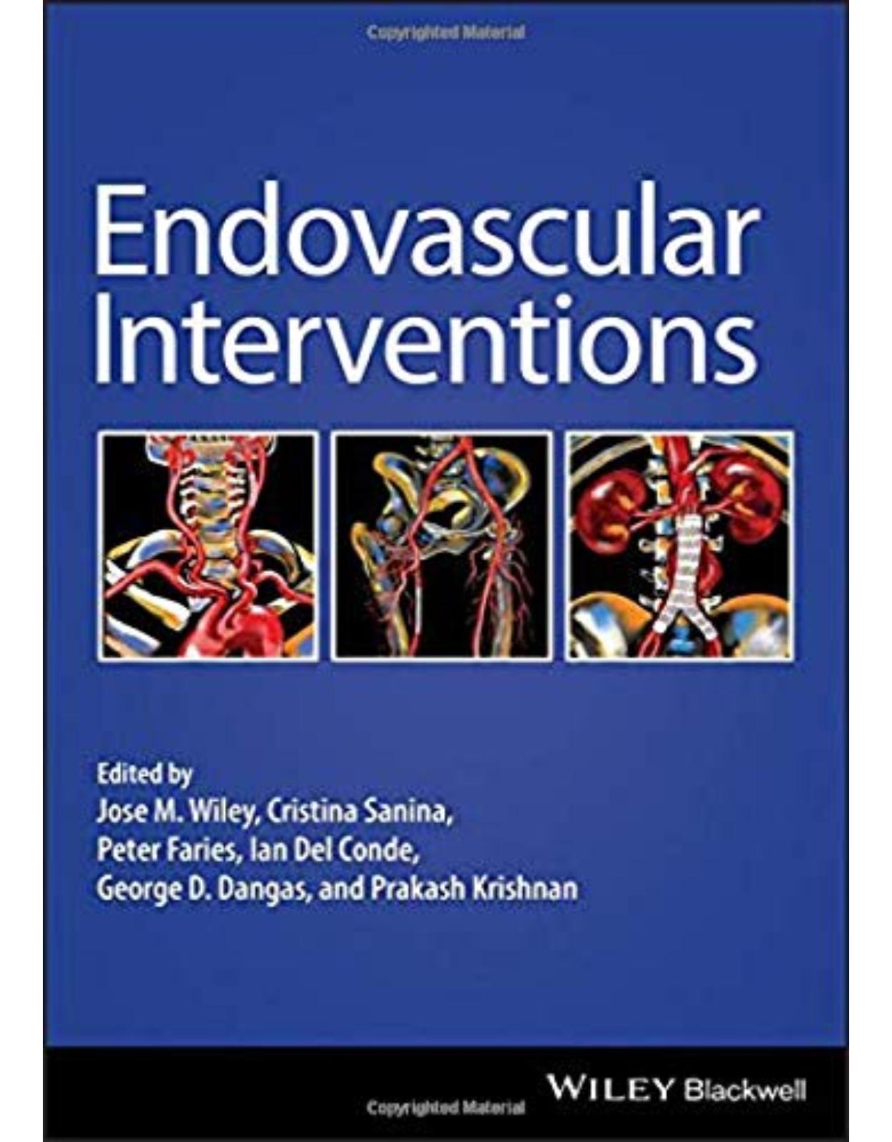 Endovascular Interventions 