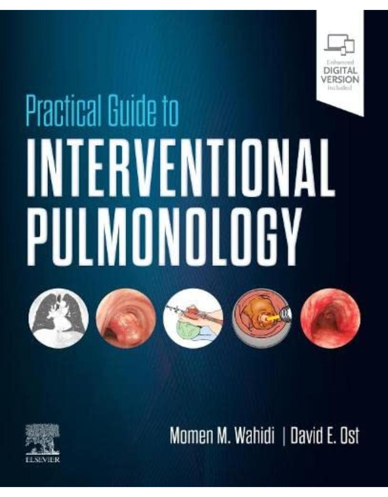 Practical Guide to Interventional Pulmonology