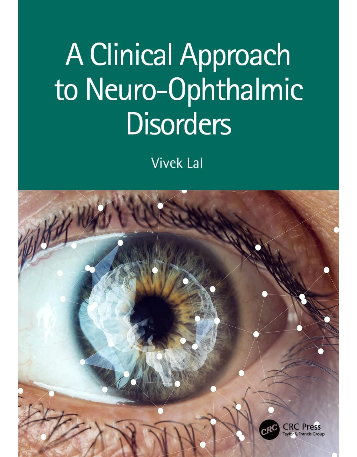 A Clinical Approach to Neuro-Ophthalmic Disorders