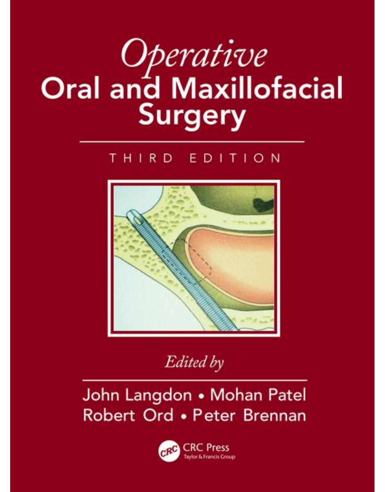 Operative Oral and Maxillofacial Surgery, Third Edition