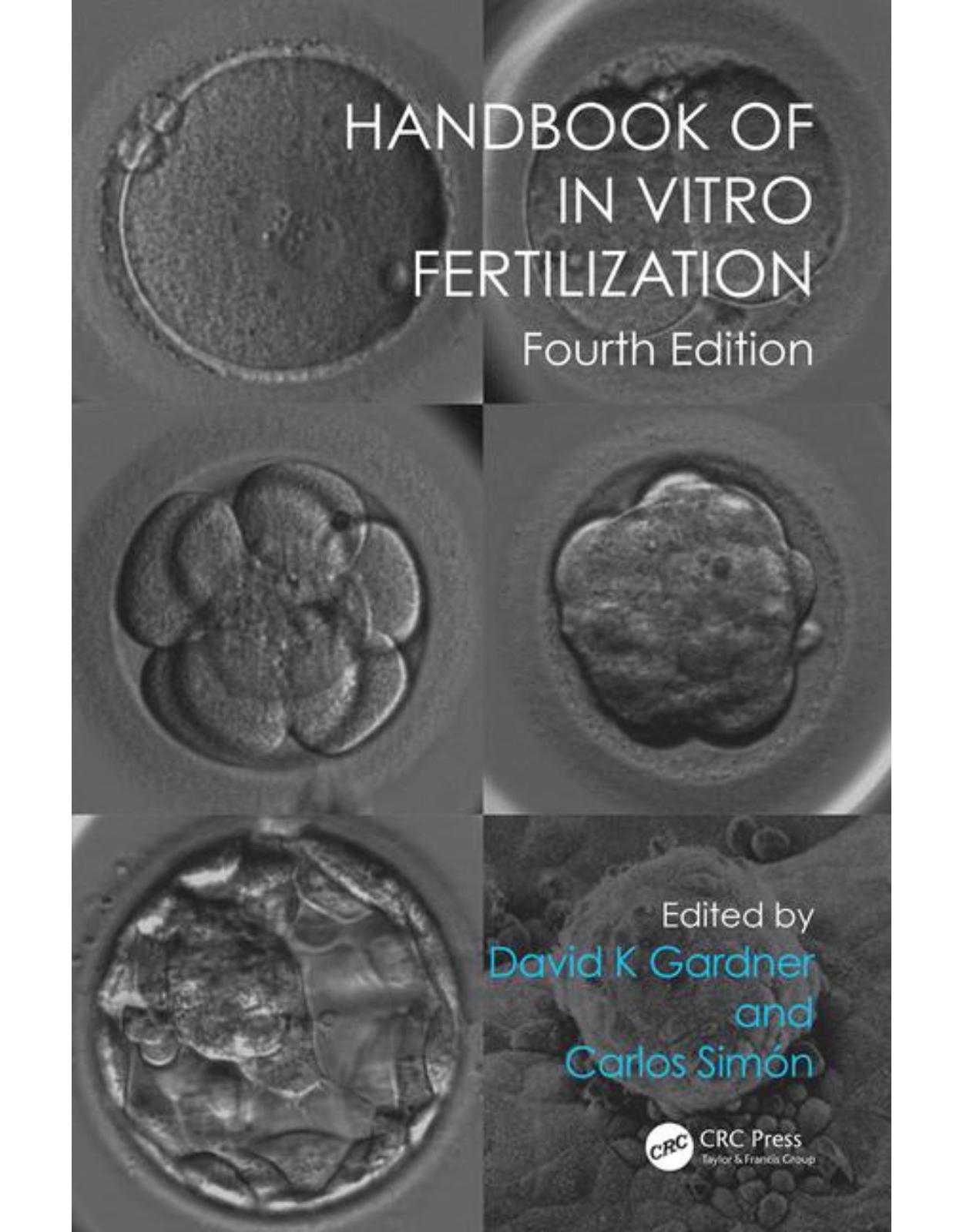  Handbook of In Vitro Fertilization, Fourth Edition