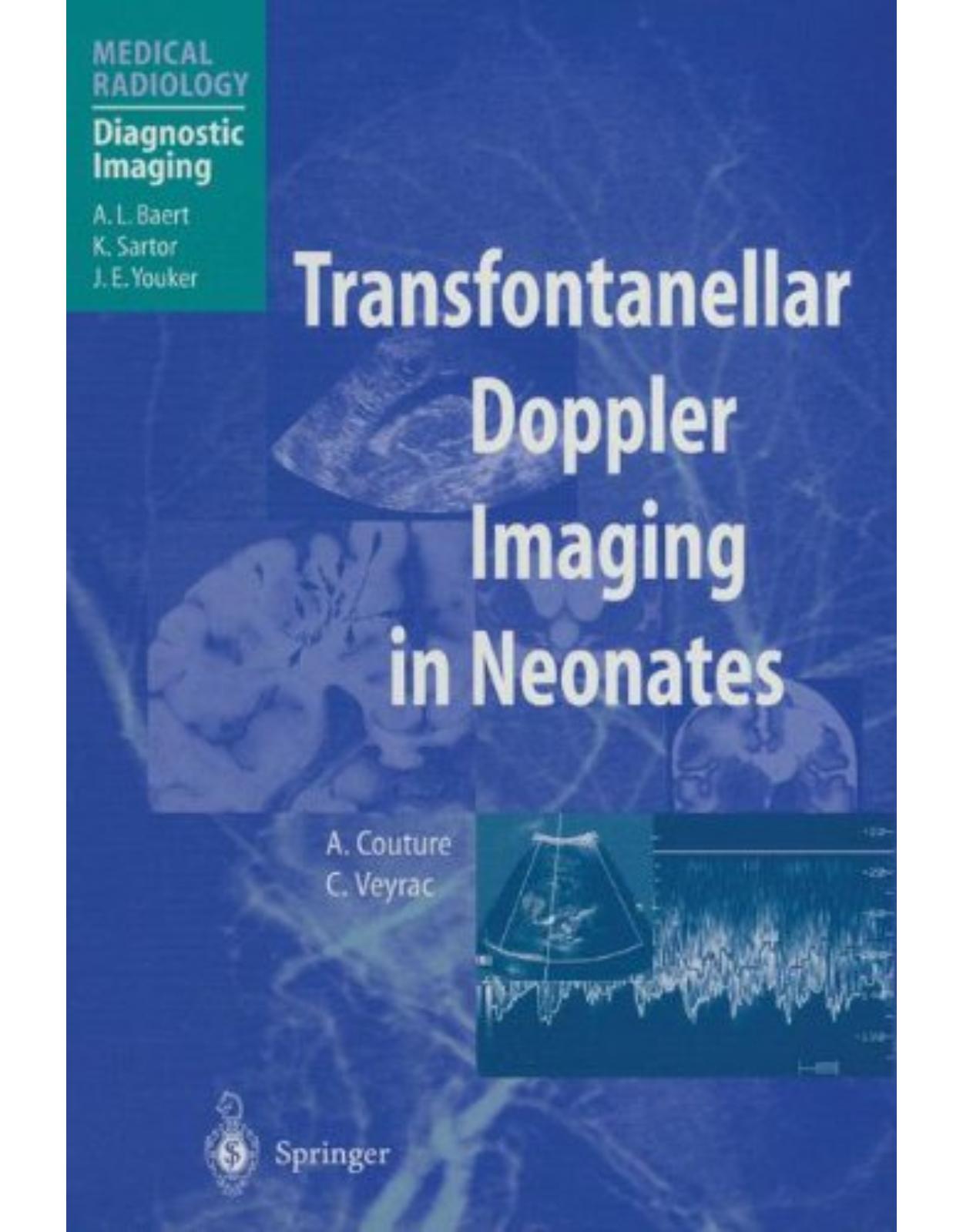 Transfontanellar Doppler Imaging in Neonates