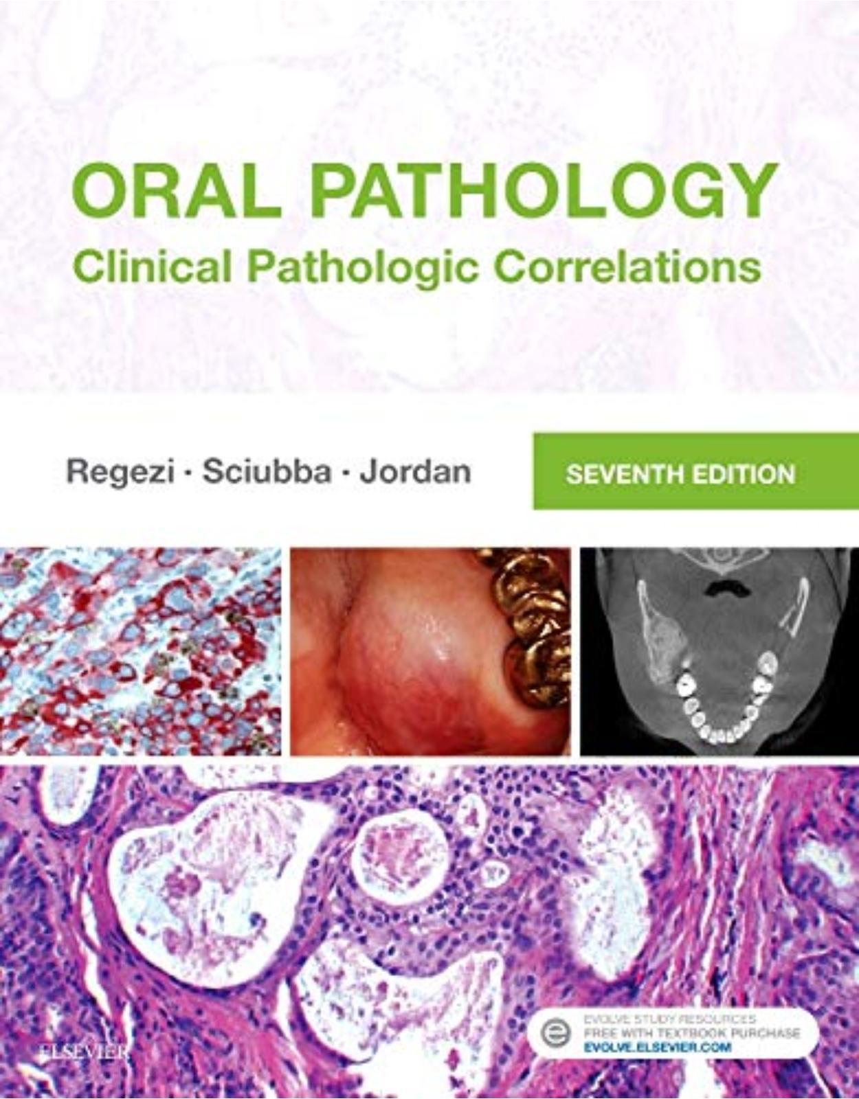 Oral Pathology: Clinical Pathologic Correlations, 7e