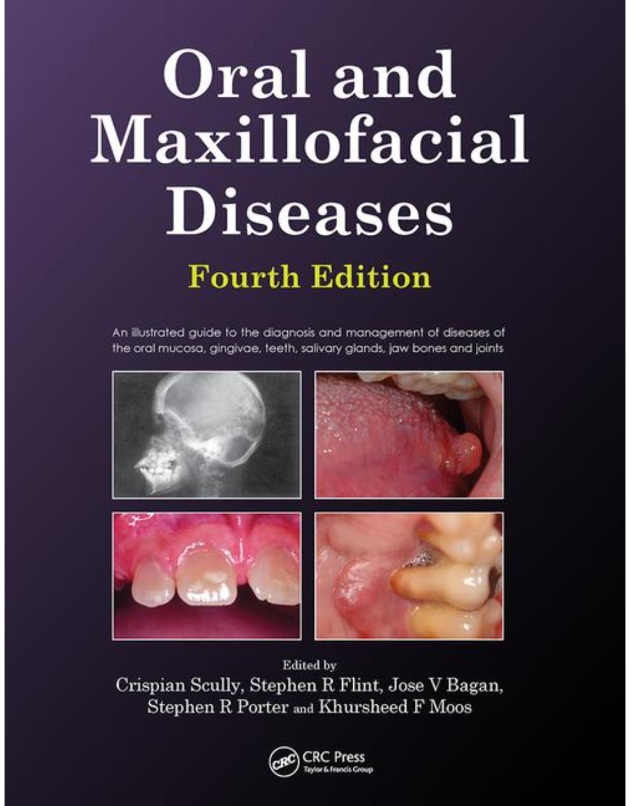 Oral and Maxillofacial Diseases, Fourth Edition 