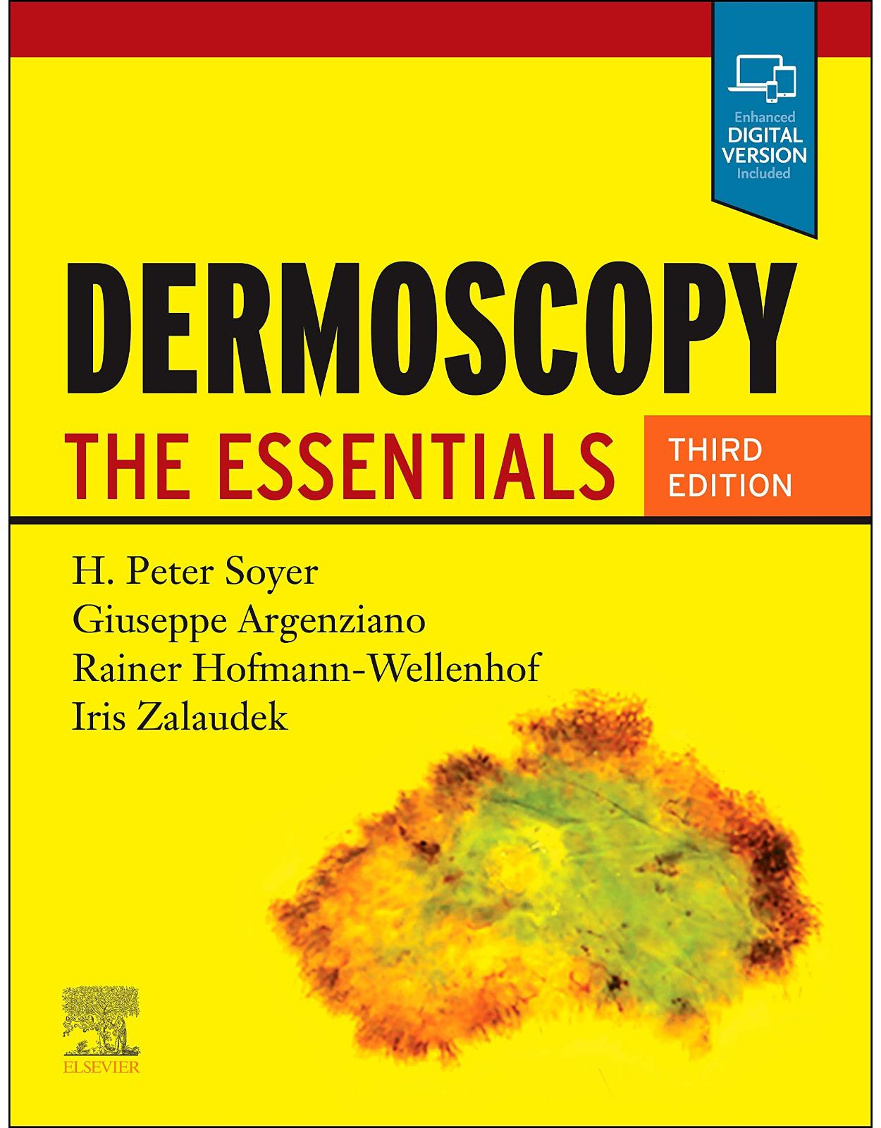 Dermoscopy: The Essentials