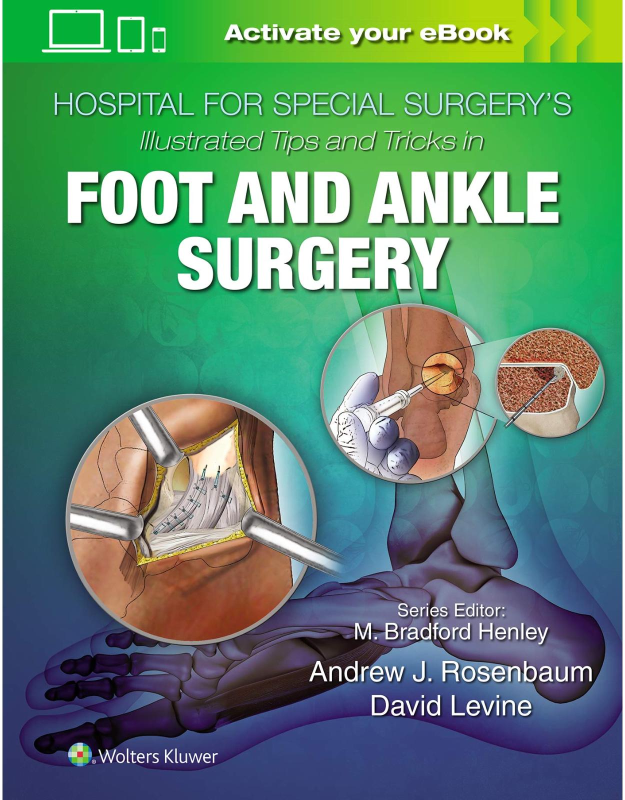Hospital for Special Surgery's Illustrated Tips and Tricks in Foot and Ankle Surgery 