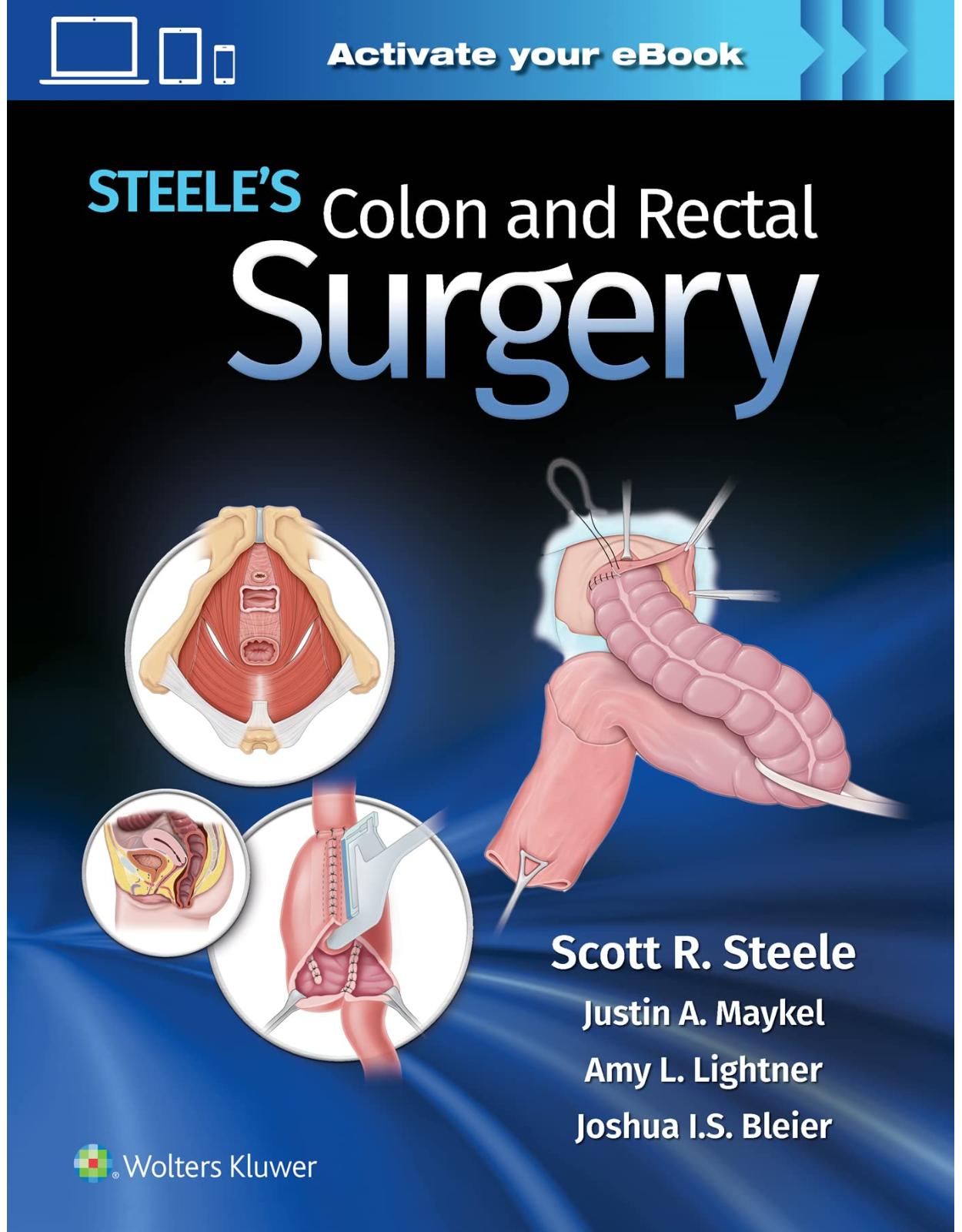 Steele's Colon and Rectal Surgery 
