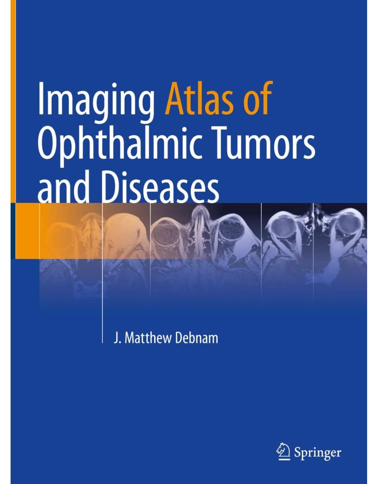 Imaging Atlas of Ophthalmic Tumors and Diseases