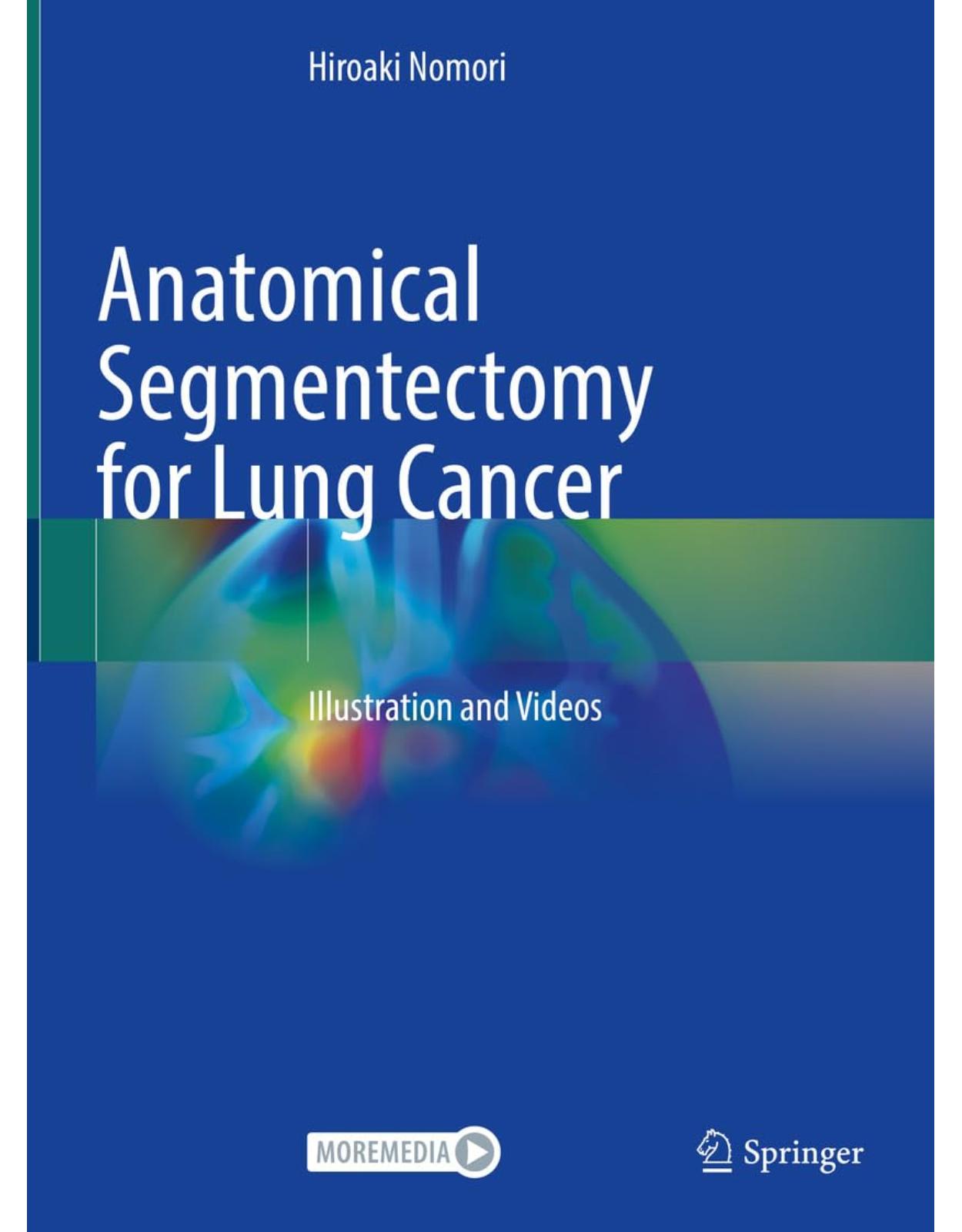 Anatomical Segmentectomy for Lung Cancer