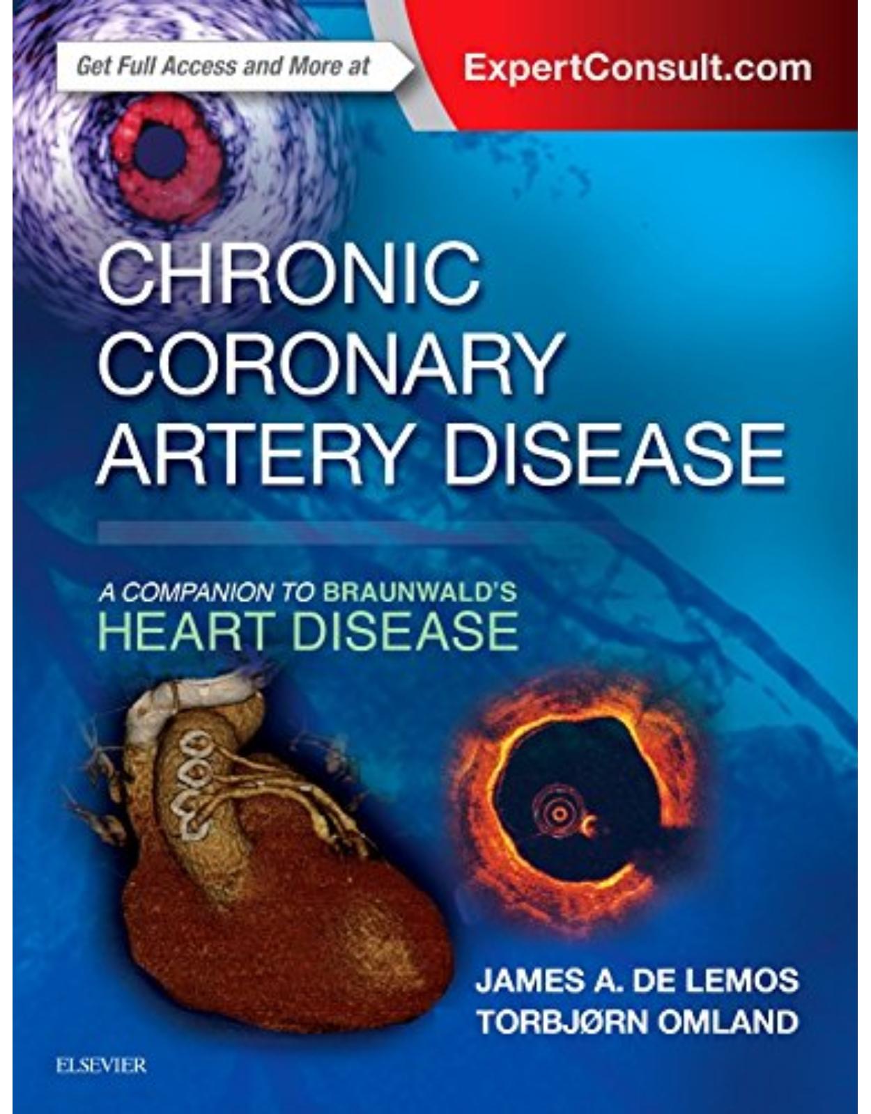 Chronic Coronary Artery Disease