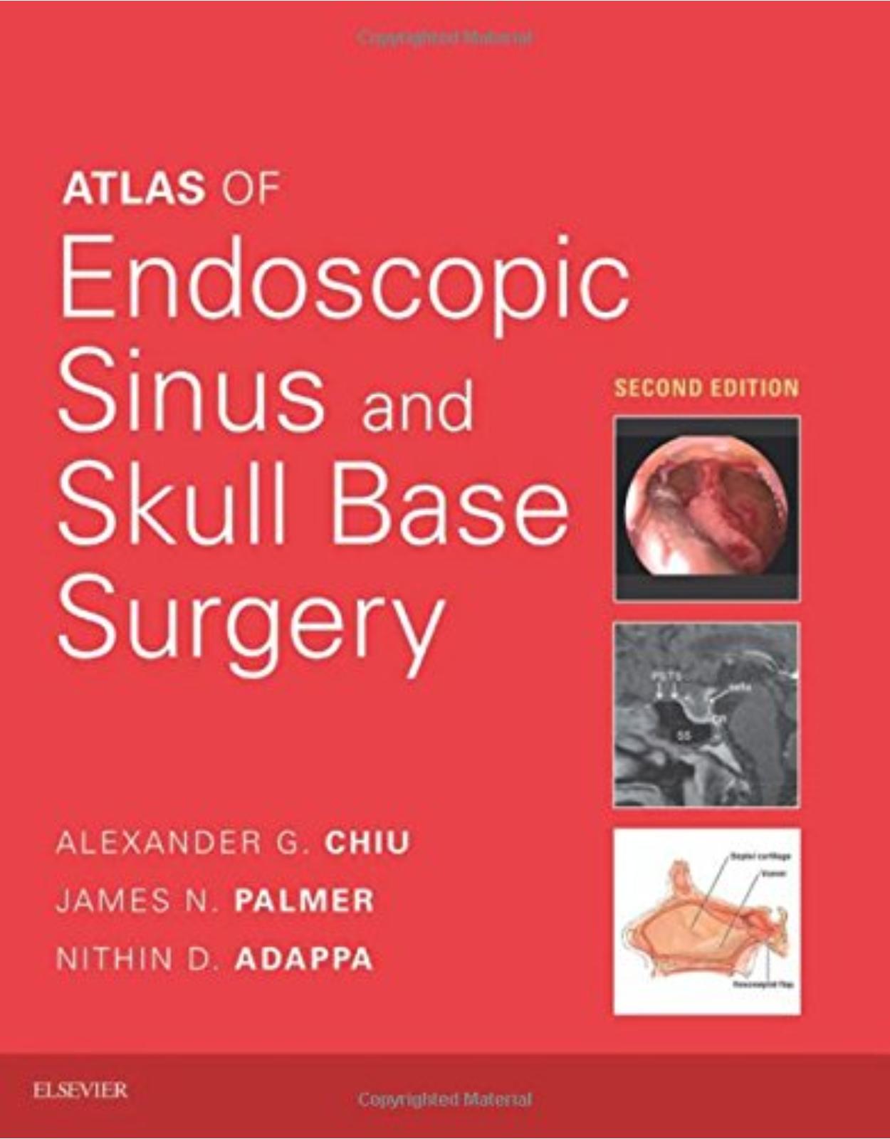 Atlas of Endoscopic Sinus and Skull Base Surgery, 2nd Edition