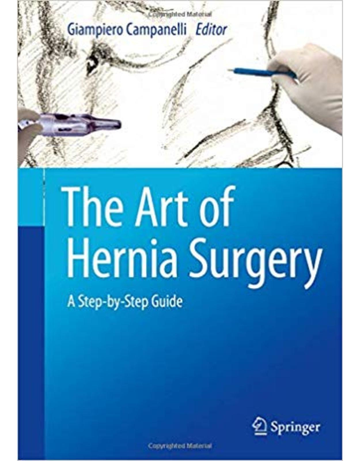 The Art of Hernia Surgery: A Step-by-Step Guide
