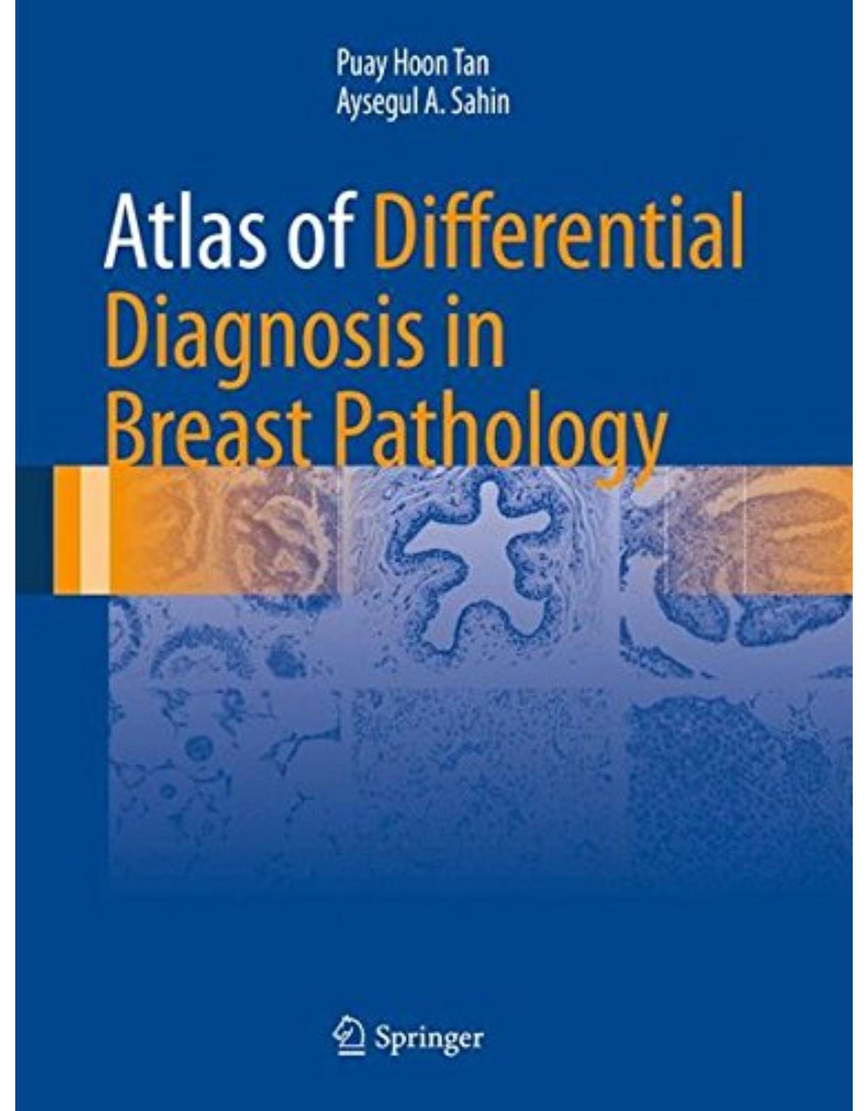 Atlas of Differential Diagnosis in Breast Pathology