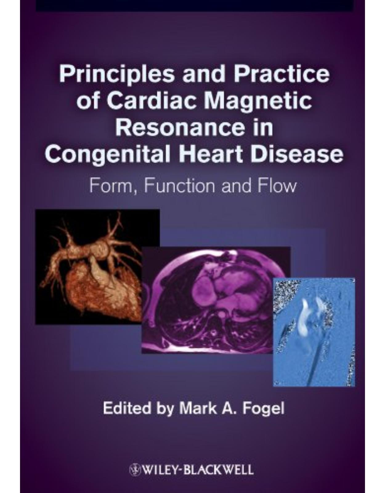 Principles and Practice of Cardiac Magnetic Resonance in Congenital Heart Disease: Form, Function and Flow