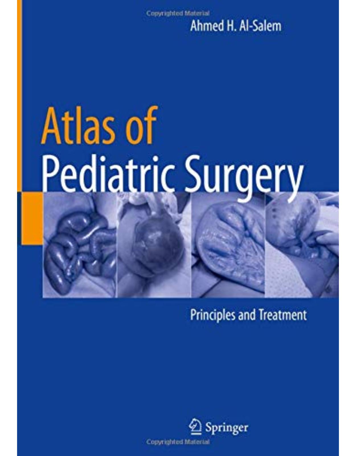 Atlas of Pediatric Surgery: Principles and Treatment 