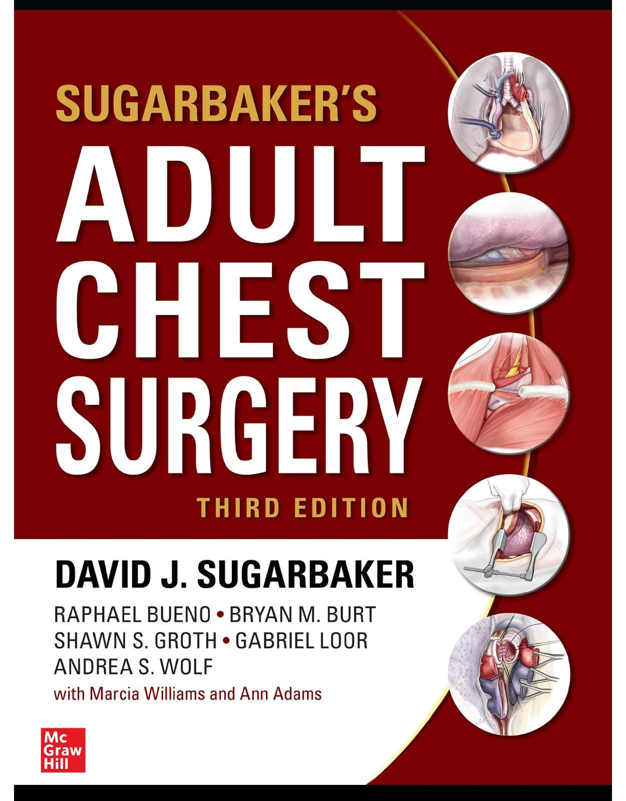 Sugarbaker's Adult Chest Surgery, 3rd edition