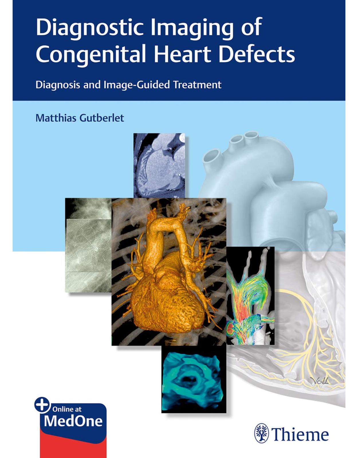 Diagnostic Imaging of Congenital Heart Defects: Diagnosis and Image-Guided Treatment