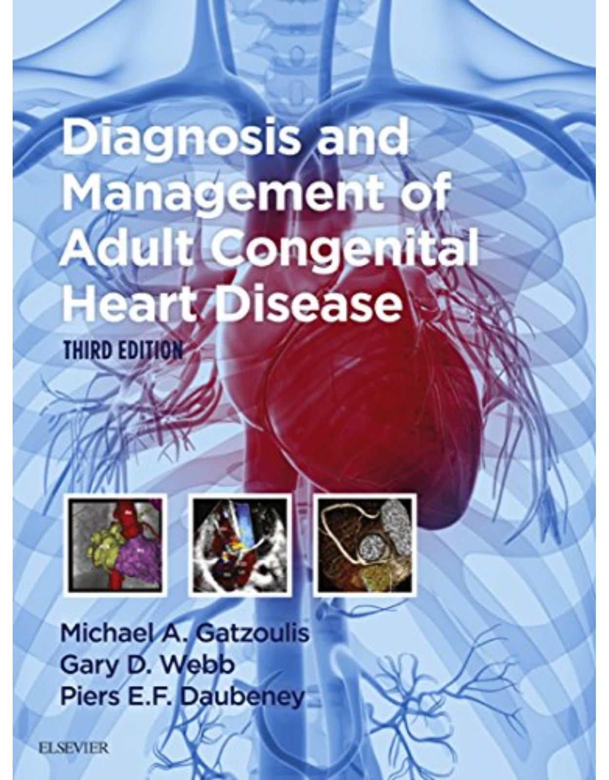 Diagnosis and Management of Adult Congenital Heart Disease, 3rd Edition