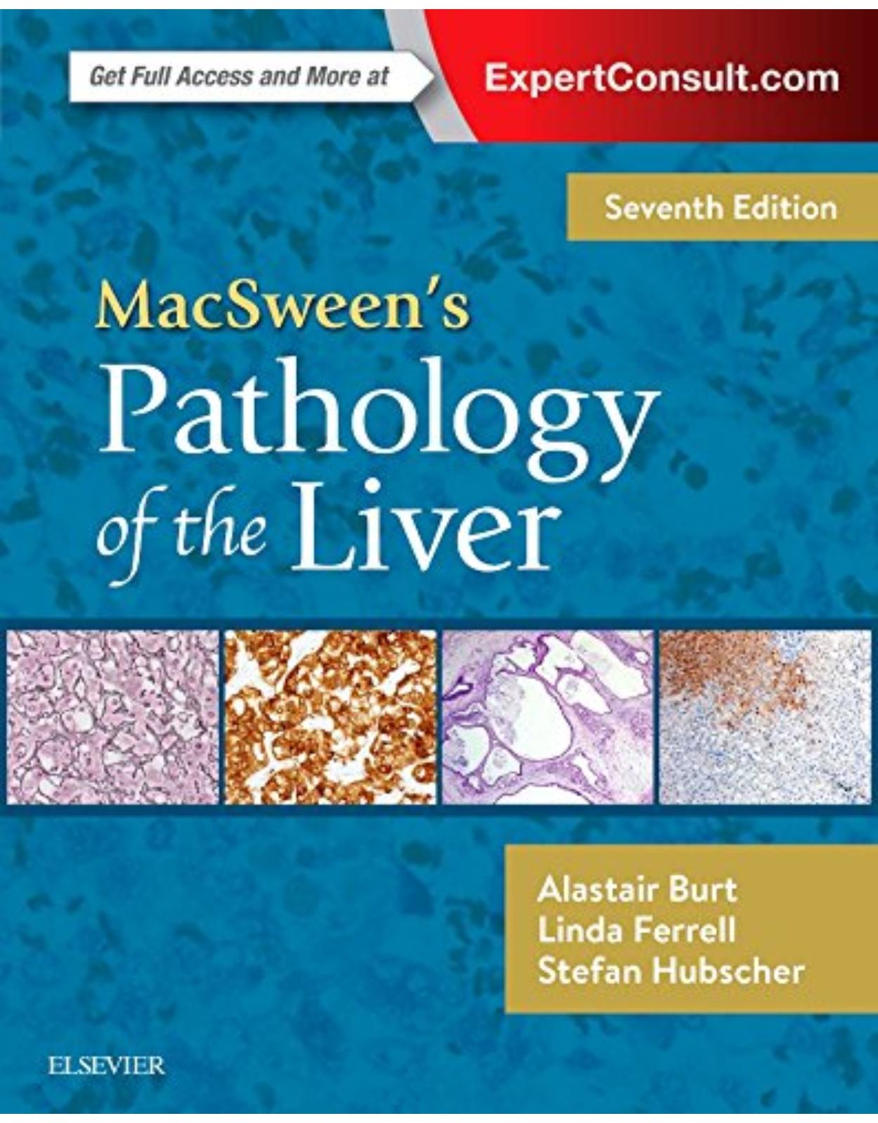 MacSween’s Pathology of the Liver, 7th Edition