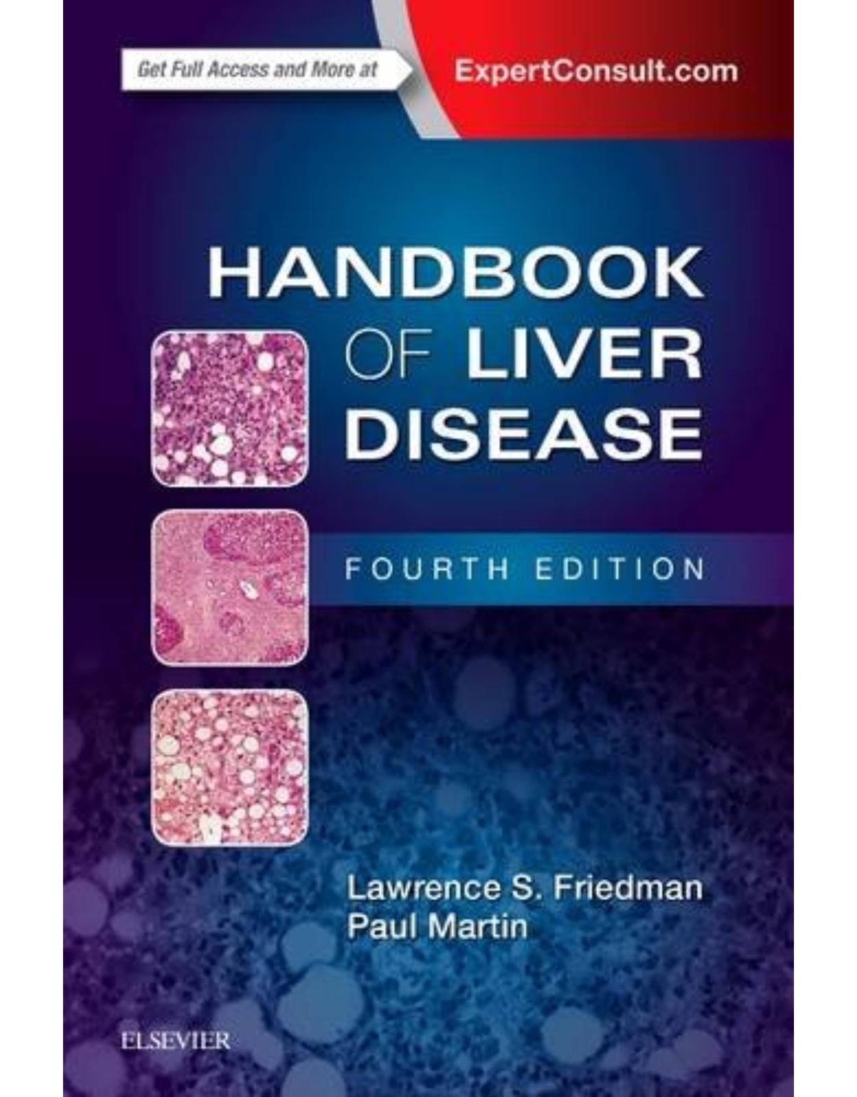 Handbook of Liver Disease, 4th Edition