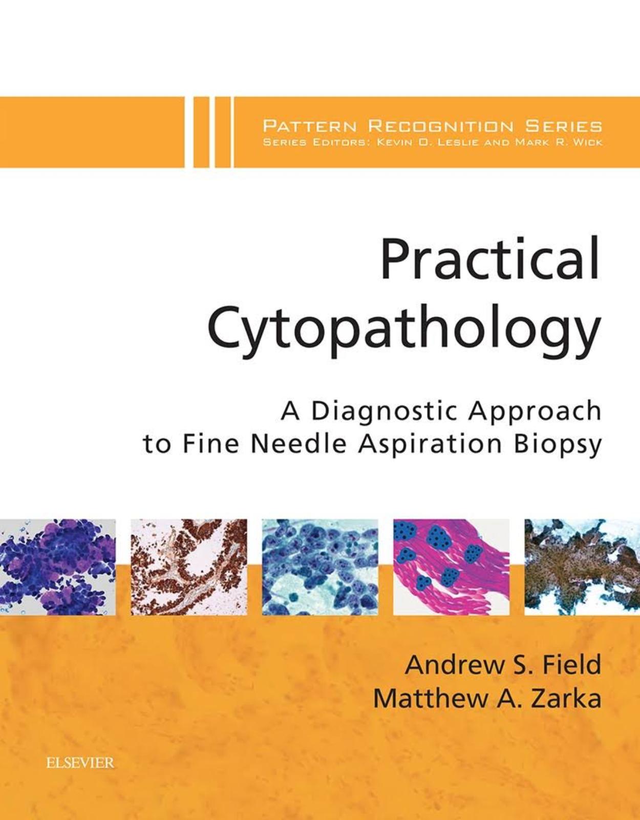 Practical Cytopathology: A Diagnostic Approach to Fine Needle Aspiration Biopsy