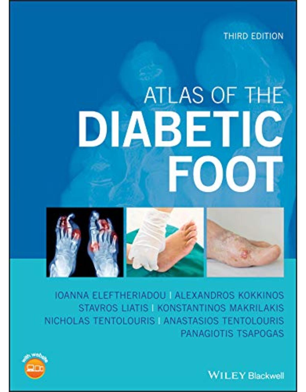 Atlas of the Diabetic Foot