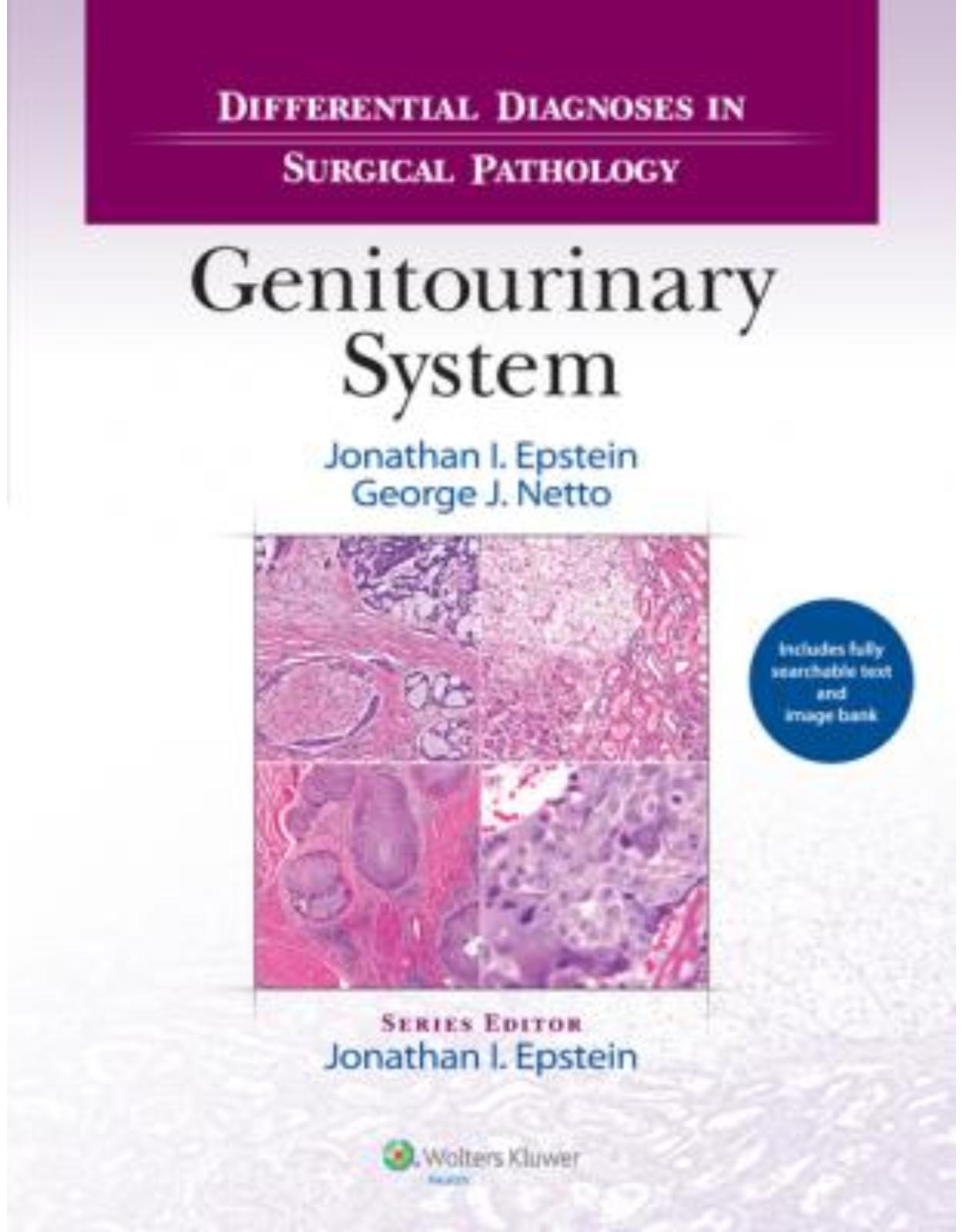 Differential Diagnoses in Surgical Pathology: Genitourinary System