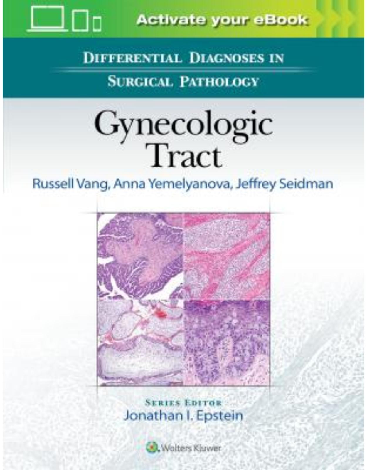 Differential Diagnoses in Surgical Pathology: Gynecologic Tract