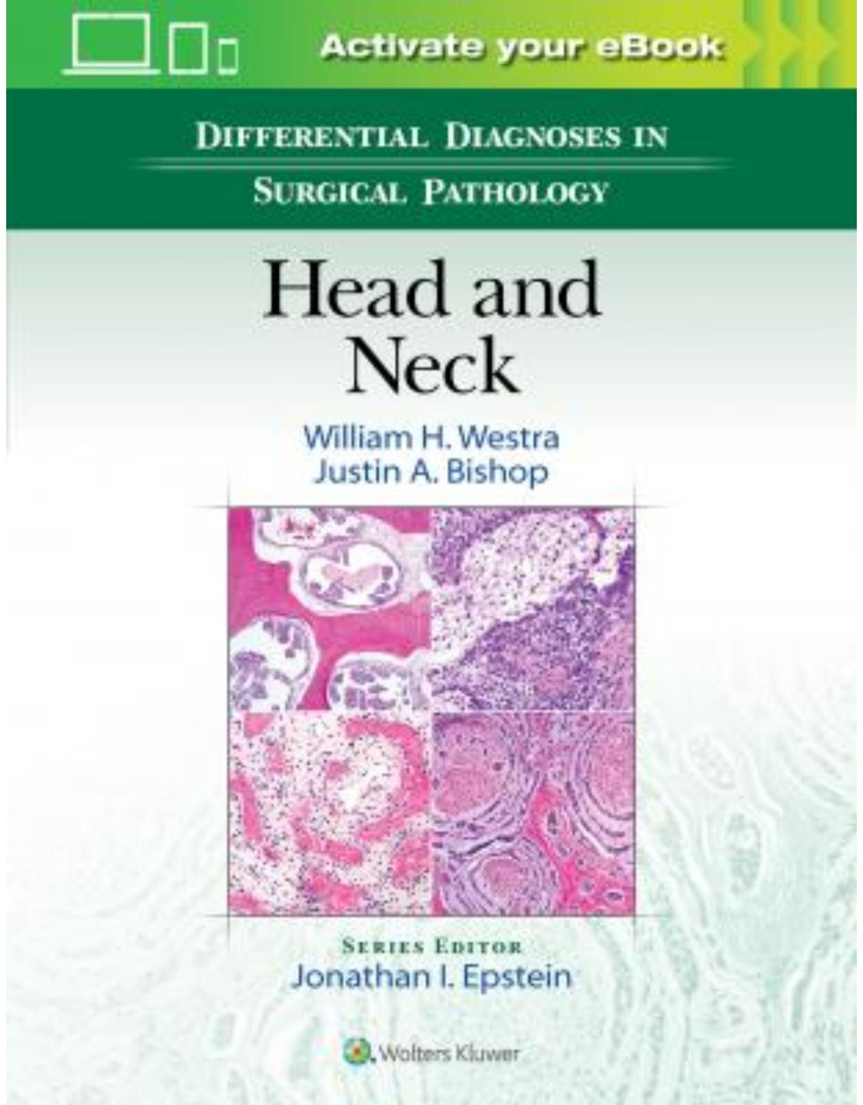 Differential Diagnoses in Surgical Pathology: Head and Neck 