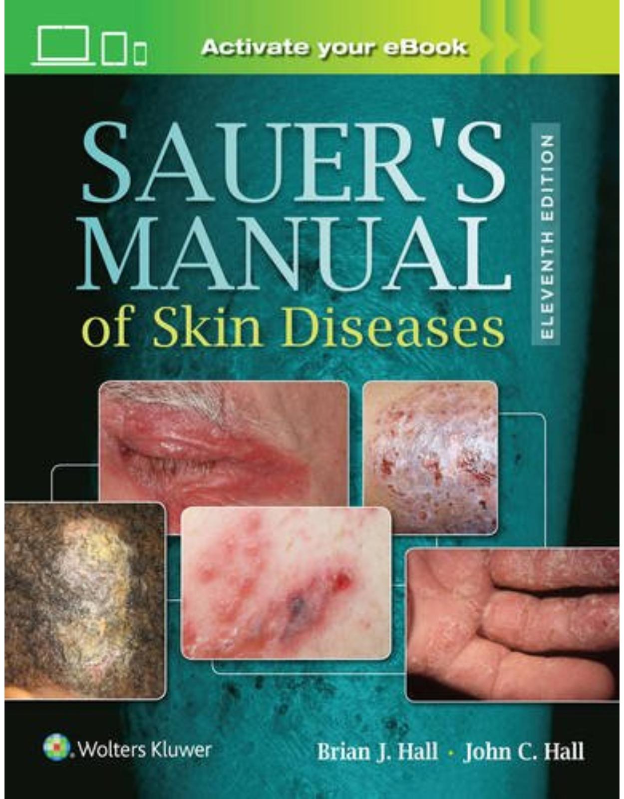 Sauer's Manual of Skin Diseases, 11e 
