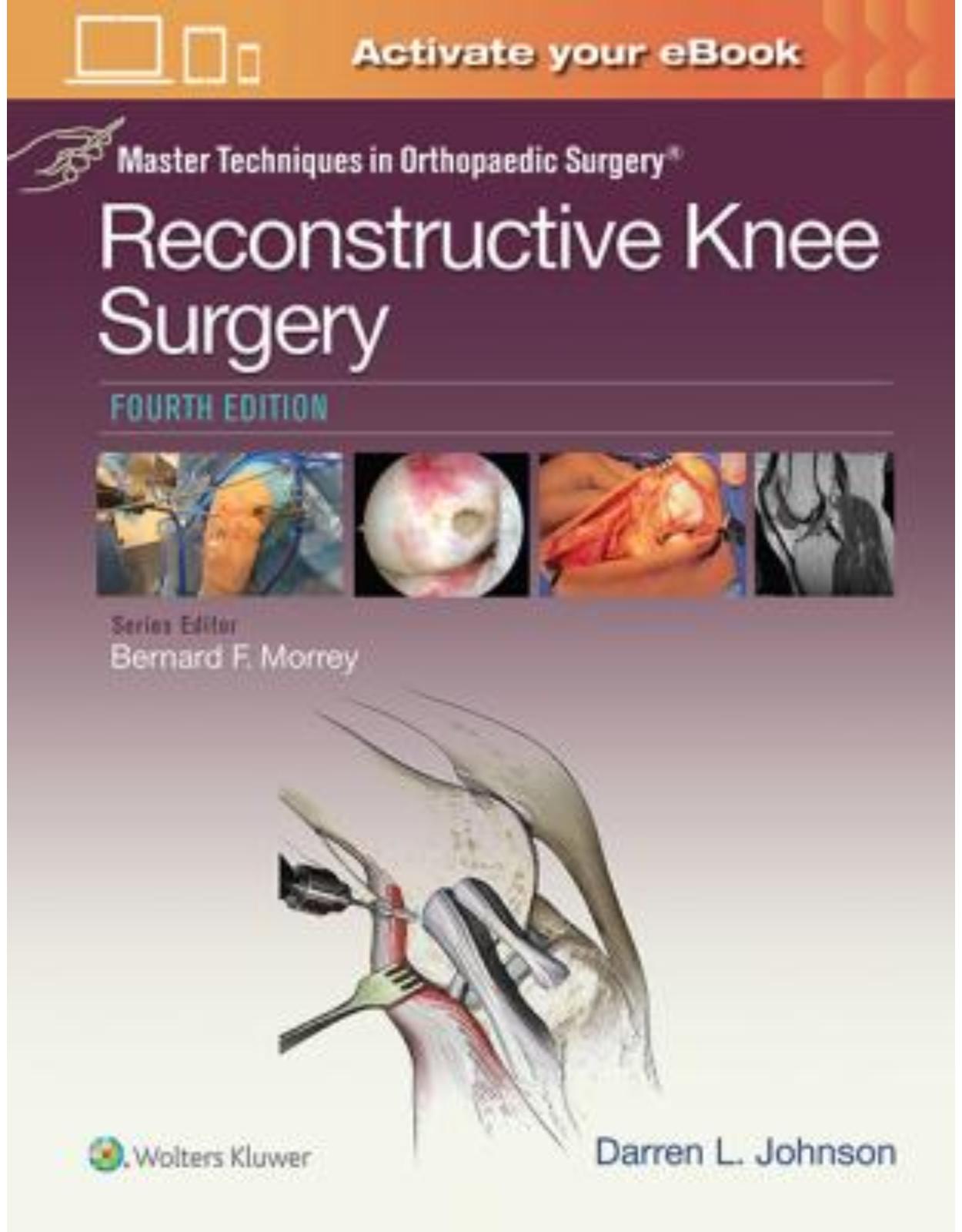 Master Techniques in Orthopaedic Surgery: Reconstructive Knee Surgery, 4e 