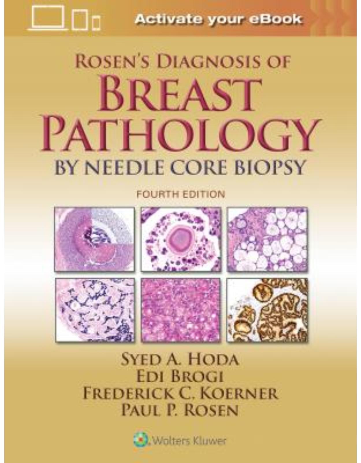Rosen’s Diagnosis of Breast Pathology by Needle Core Biopsy, 4e 