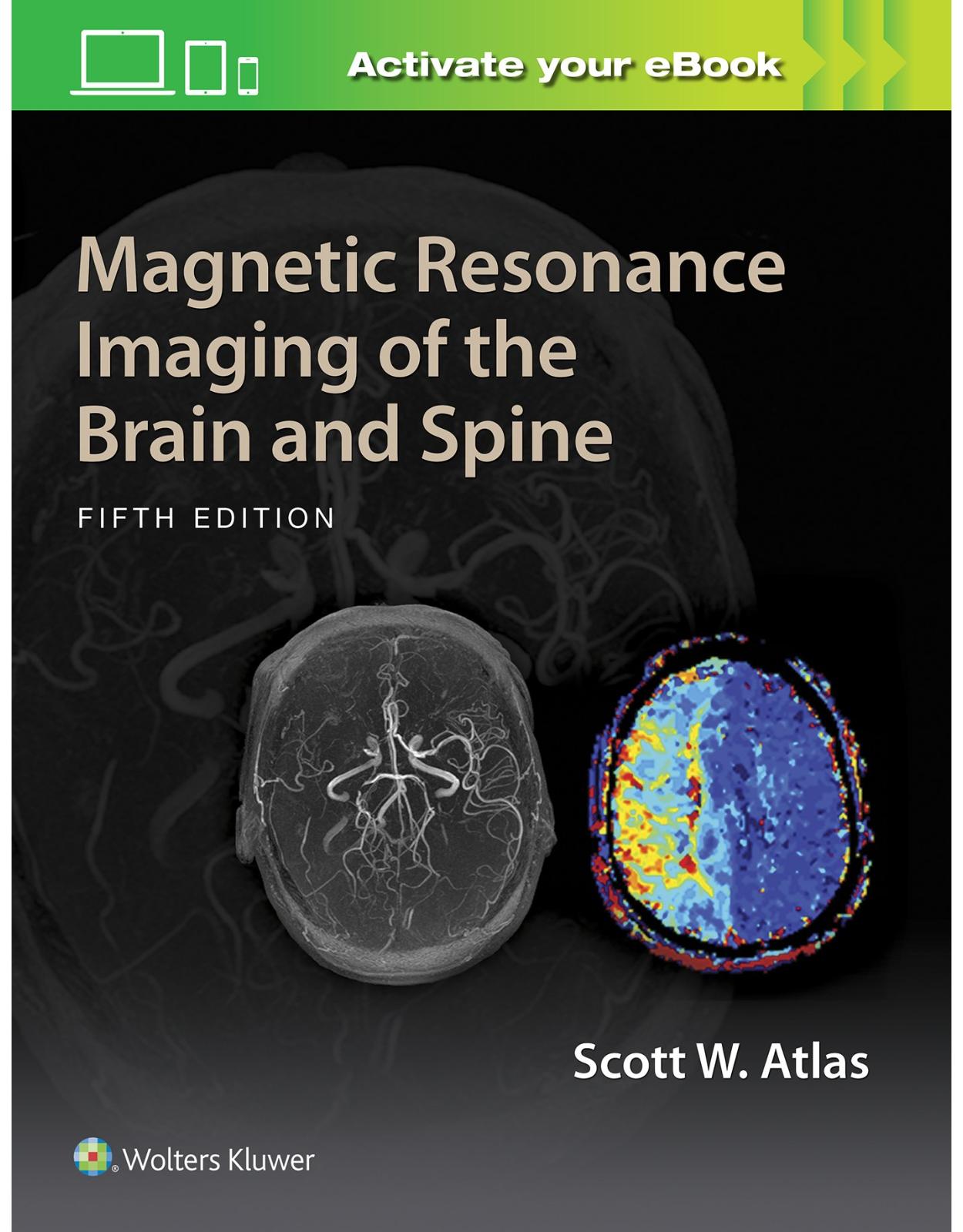 Magnetic Resonance Imaging of the Brain and Spine, 5e