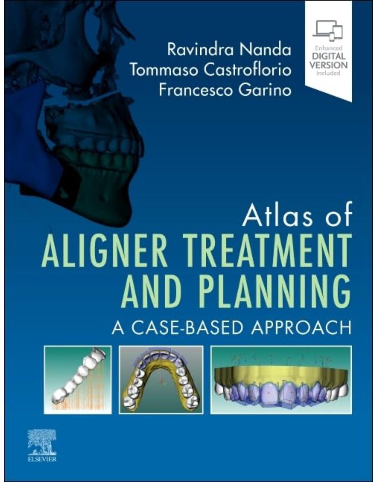 Atlas of Aligner Treatment and Planning: A Case-Based Approach