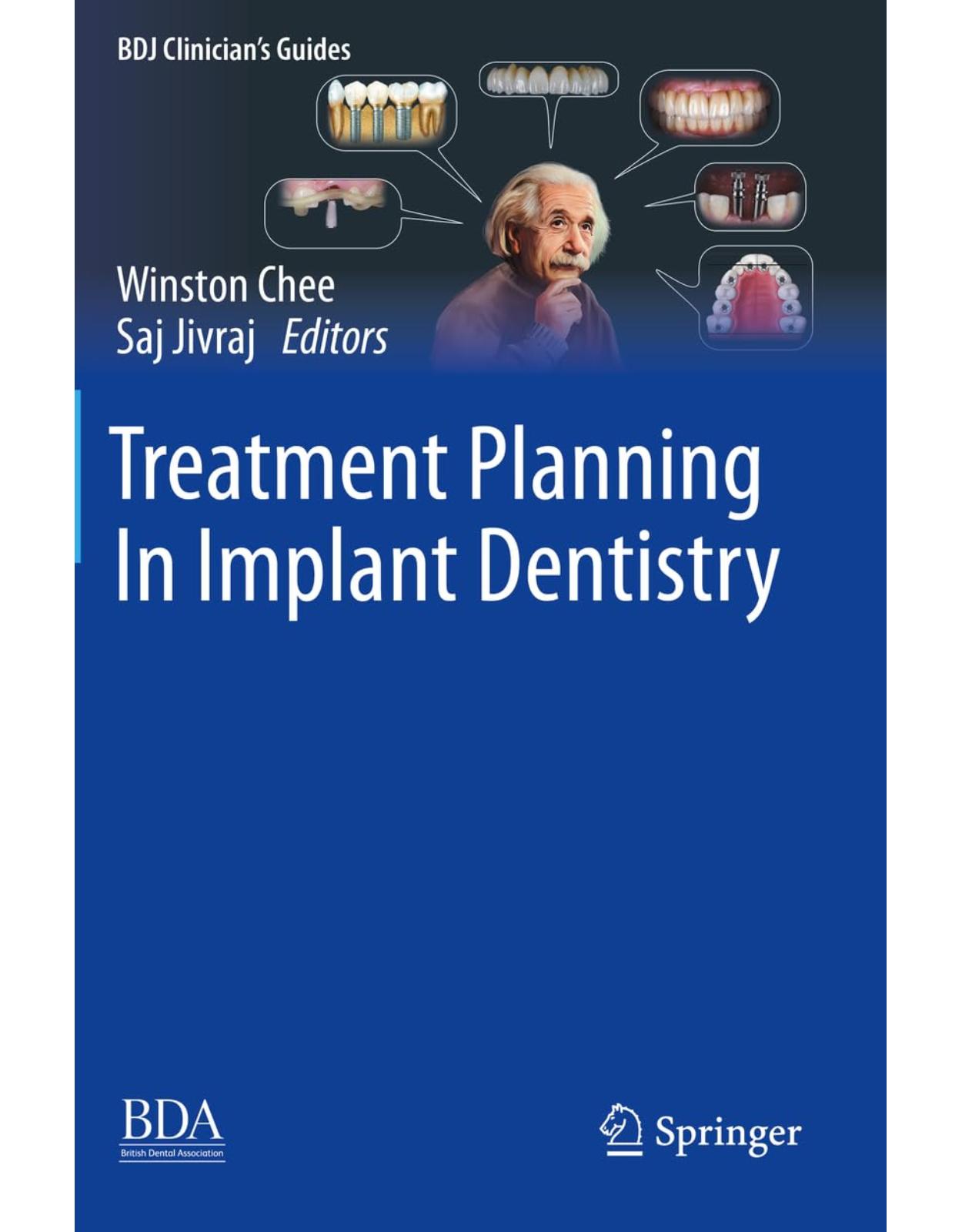 Treatment Planning In Implant Dentistry (BDJ Clinician�s Guides)