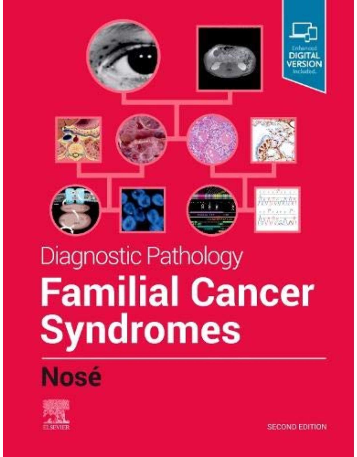 Diagnostic Pathology: Familial Cancer Syndromes, 2nd Edition