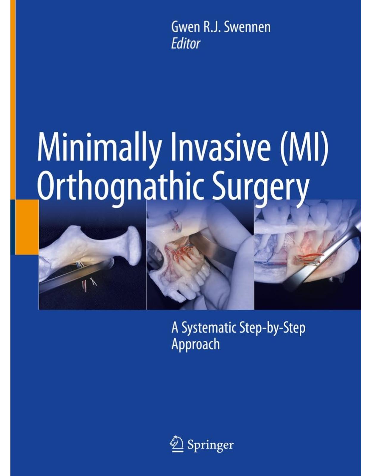 Minimally Invasive (MI) Orthognathic Surgery: A Systematic Step-by-Step Approach (Medicine)