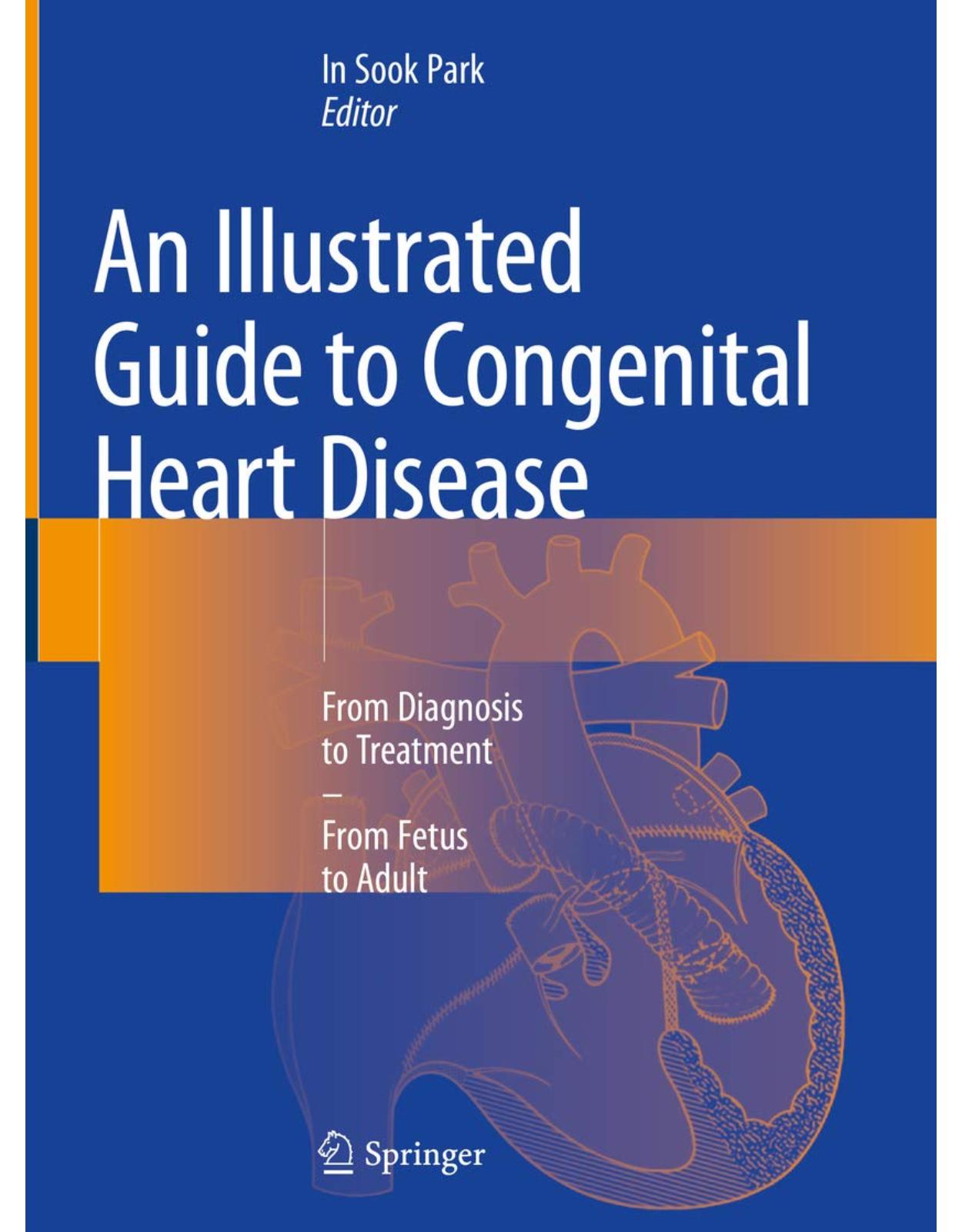 An Illustrated Guide to Congenital Heart Disease: From Diagnosis to Treatment  From Fetus to Adult